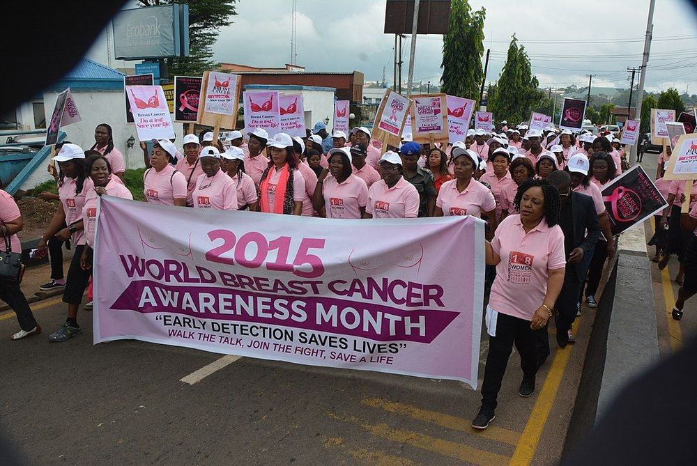 Pinktober: 3 FAQs about Breast Cancer Screening